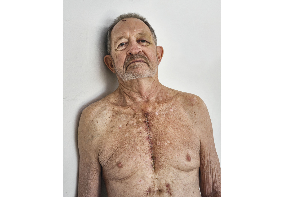 Pieter Hugo - Dad after heart surgery, Cape Town, 2021