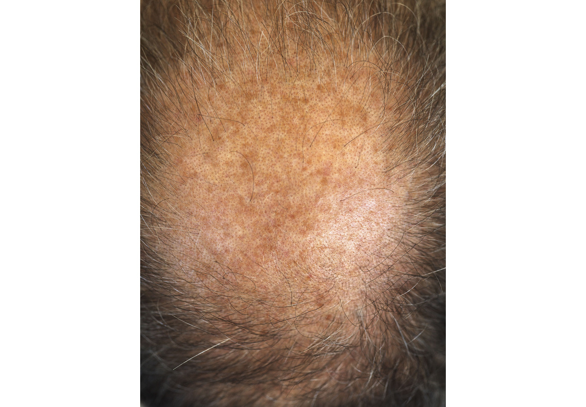 Pieter Hugo - Gigi’s head, Cape Town, 2021